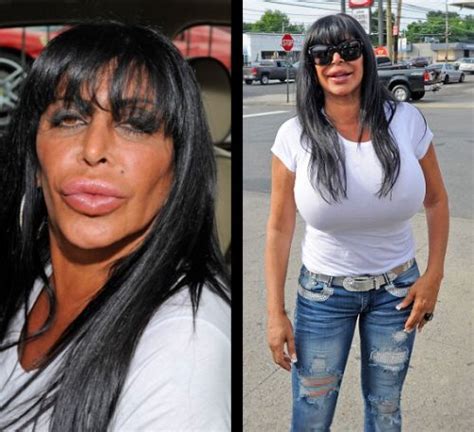 However! If you are someone who can nip and. . Worst celebrity plastic surgery